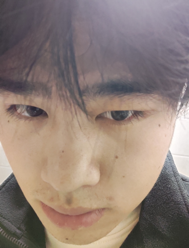 伤男的第一张照片--光泽交友网